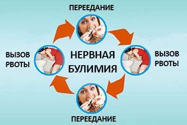 Лечение булимии в Леникенте